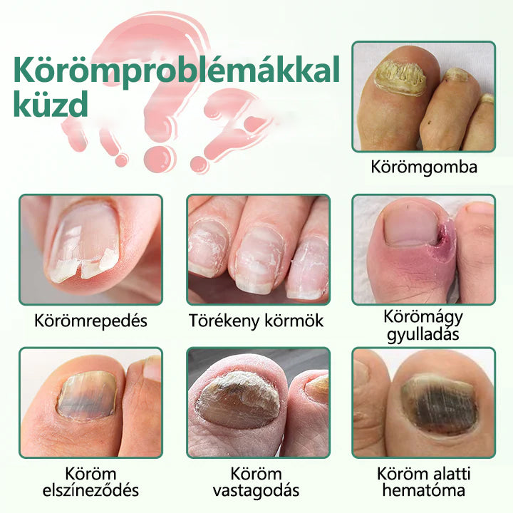 ☁️Laleia® Köröm Detox Behatoló Szérum Toll