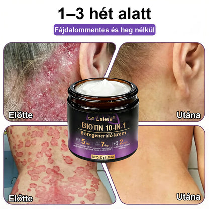 ✨Laleia® Biotin 10 az 1-ben bőr helyreállító krém