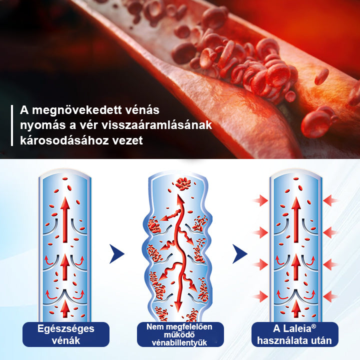 💎Laleia® Mélyvénás Javító Mikrotűs Tapasz