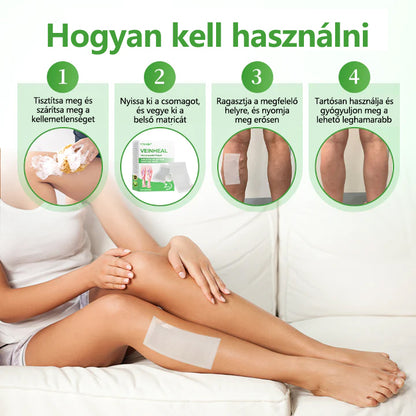 🔥🔥🔥Laleia® VeinHeal mikrotűs tapasz