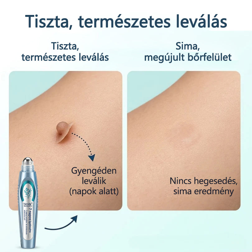 Timilk® SpotlessPro Fejlett Bőrápoló Toll