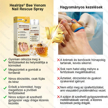🌿 Laleia® Méhméreg Körömmentő Spray