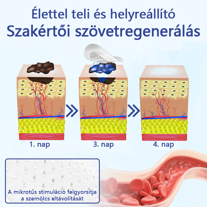 🔥 Laleia® DermalRepair 2 az 1-ben mikrotűs és hidrokolloid tapasz 💉