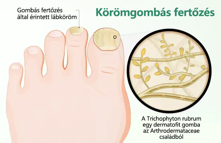 ☁️Laleia® Köröm Detox Behatoló Szérum Toll