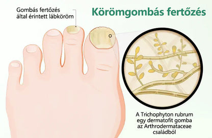 ☁️Laleia® Köröm Detox Behatoló Szérum Toll