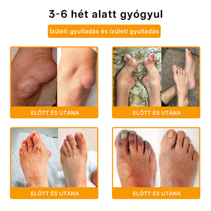 🌿🌿Laleia® Botulinum Toxin és Méhméreg Fájdalomcsillapító Csontgyógyító Krém🐝 (Kifejezetten időseknek & ortopéd szakorvosok ajánlásával)