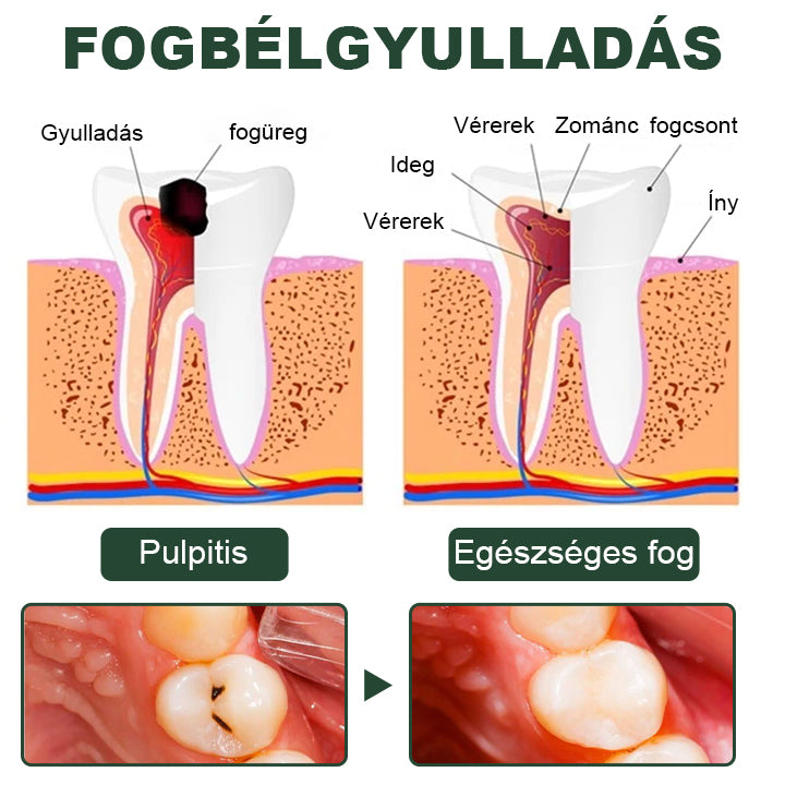 🌿Laleia® Fűzfakéreg Fogspray
