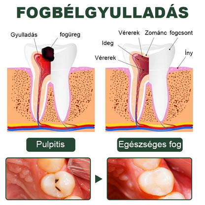 🌿Laleia® Fűzfakéreg Fogspray