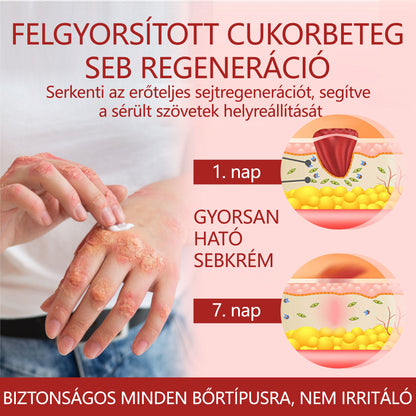 ⭐⭐Laleia® GlucoseGuard bőrmentő krém