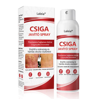 🔥🔥Laleia® csigahéjas spray viszkető, hámló pikkelysömörös bőrre