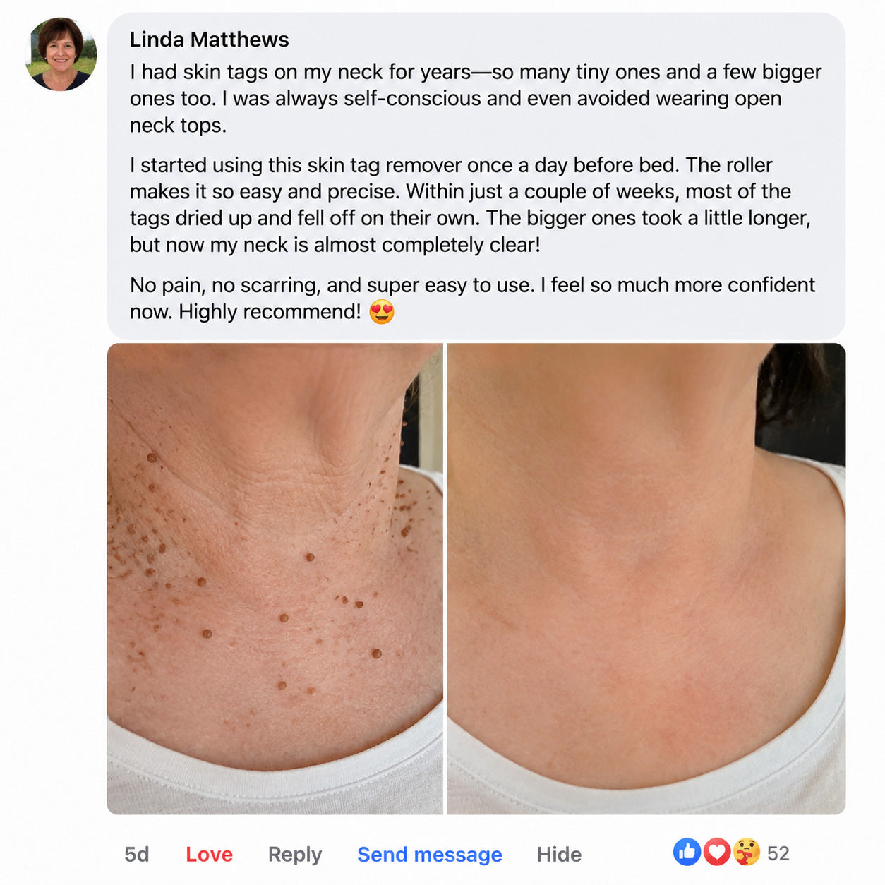 ✨Laleia® DermaSpot Precision Renewal Pen