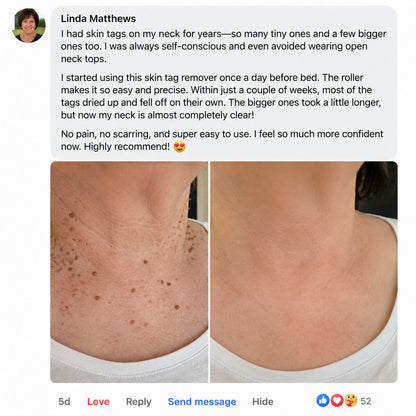 ✨Laleia® DermaSpot Precision Renewal Pen